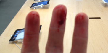 bloody fingers